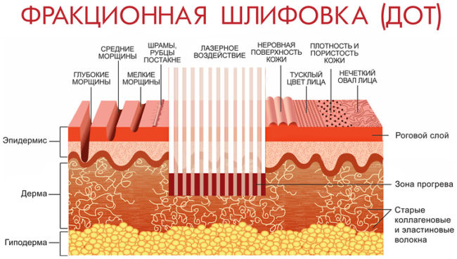 ДОТ-омоложение