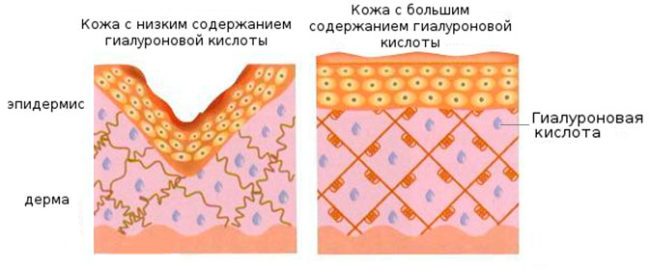 Содержание гиалуроновой кислоты в коже